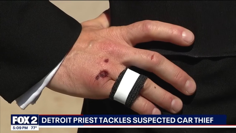 A closeup of the Detroit priest's bandaged right hand and scabbed over injuries on his knuckles, a result of his struggle trying to stop the teen-aged suspect